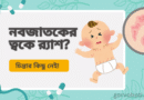 নবজাতকের ত্বকে র‍্যাশ? চিন্তার কিছু নেই!