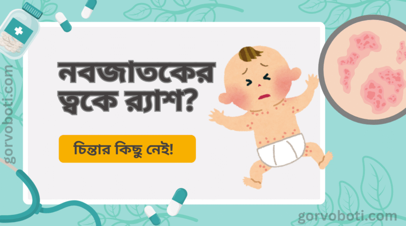 নবজাতকের ত্বকে র‍্যাশ? চিন্তার কিছু নেই!