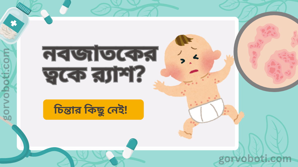 নবজাতকের ত্বকে র‍্যাশ? চিন্তার কিছু নেই!